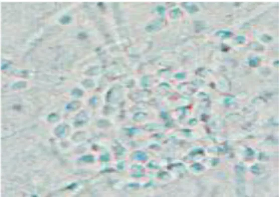 Gambar 2.1  Gambaran mikrokopis candida, tampak adanya budding yeasts dengan  hypa dan pseudohypa