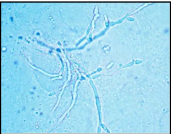 Gambar 2. Pertumbuhan  Candida  albicans pada media Sabouraud  Dekstrosa Agar 