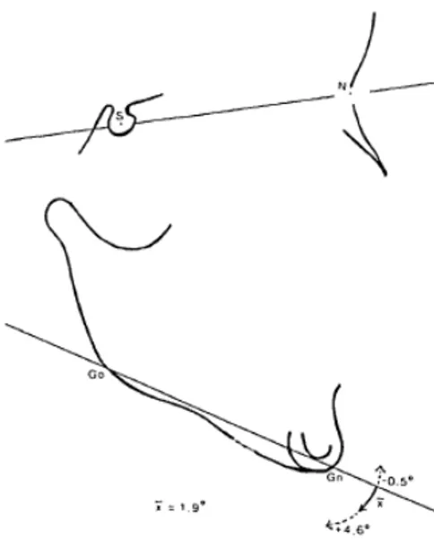 Gambar 13. Pengaruh RPE, mandibula bergerak                       ke bawah dan belakang
