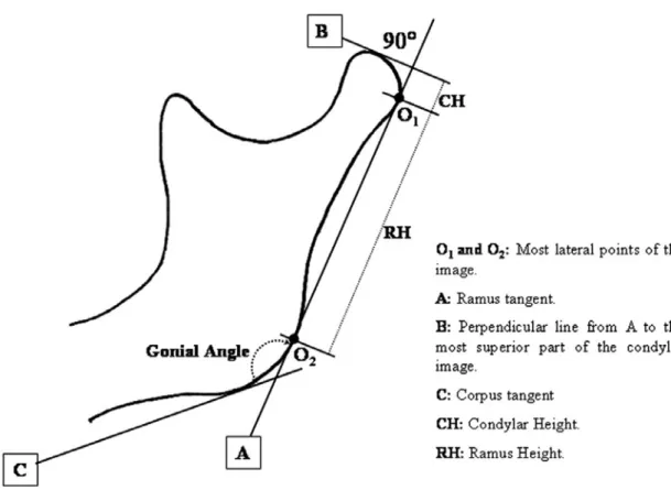 Gambar  2.7Metode pengukuran  sudut gonial  berdasarkan  Raminez-Yanez,  sudut gonial mandibula yaitu sudut yang dibentuk oleh garis  singgung posterior ramus-kondilus  dengan garsis singgung  inferior korpus
