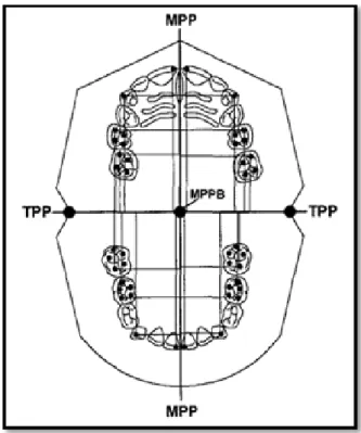 Gambar 2.2. Perhitungan asimetri lengkung  gigi pada teknik yang dipakai   Maurice dkk 28