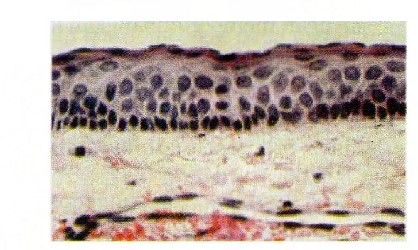 Gambar 1. Lumen yang dilapisi oleh lapisan epitel yang mengalami keratinisasi 1 
