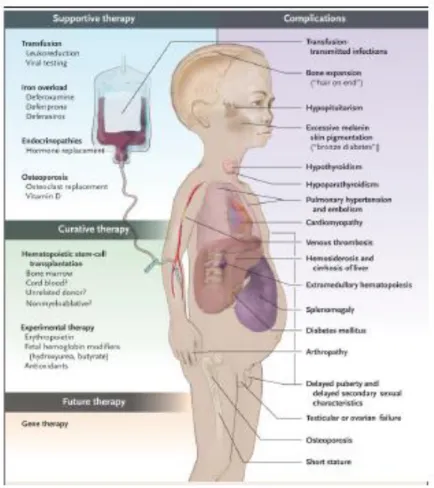 Gambar 2-7: Komplikasi yang terjadi pada thalassemia³³. 