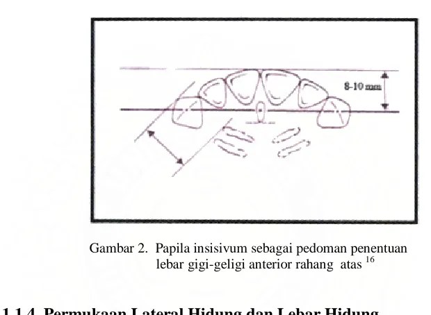 Gambar 2.  Papila insisivum sebagai pedoman penentuan     lebar gigi-geligi anterior rahang  atas 16 
