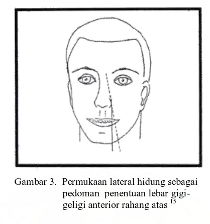 Gambar 4.   Lebar hidung sebagai pedoman penentuan       lebar gigi-geligi anterior rahang atas 17 