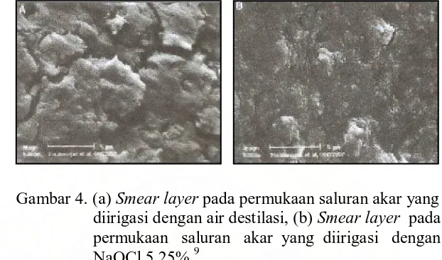 Gambar 4. (a) Smear layer pada permukaan saluran akar yang        diirigasi dengan air destilasi, (b) Smear layer  pada                 permukaan   saluran   akar  yang  diirigasi   dengan  