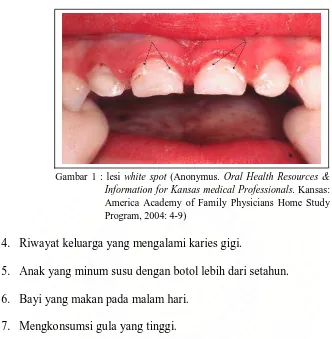 Gambar 1 : lesi white spot (Anonymus. Oral Health Resources & . Kansas: 