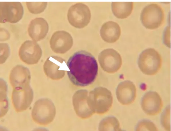 Gambar 5  Sel darah putih (leukosit), limfosit. (Sumber : http://Id.wikipedia.org) 