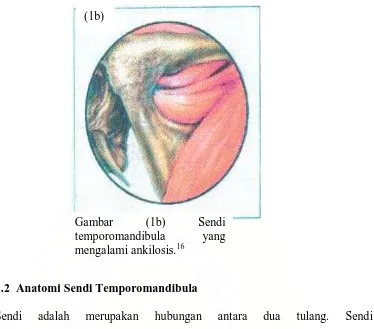 Gambar temporomandibula 
