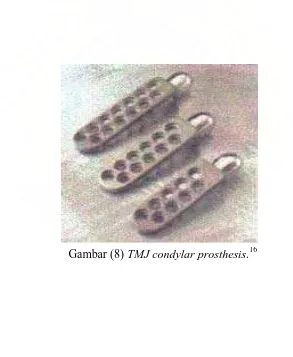 Gambar (7a) dan (7b)  Christensen TMJ fossa eminence prosthesis.16 