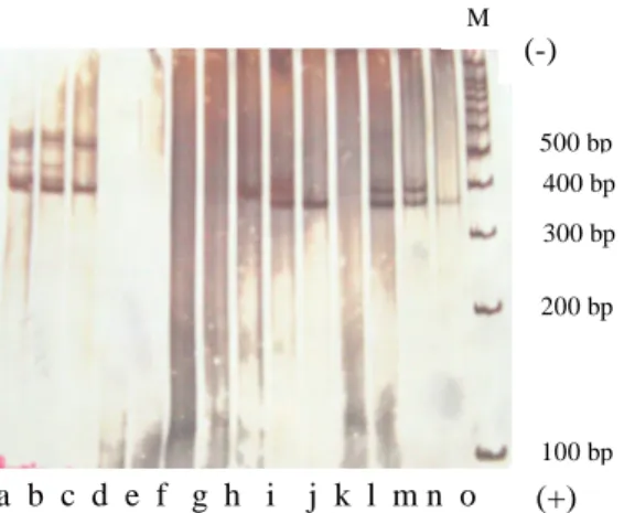 Tabel 2 Hasil PCR berdasarkan DNA cetakan  dari ketiga metode ekstraksi 