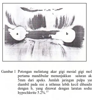 Gambar 1. Potongan melintang akar gigi mesial gigi molar pertama mandibular menunjukkan  saluran akar 