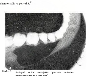 Gambar 6.  Radiografi 