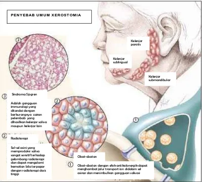 Gambar 1. Penyebab Umum Xerostomia 6 