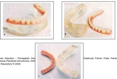 Gambar 11. Anasir gigitiruan mandibular split-denture,       di modelir  dan  dioklusikan  dengan anasir      gigitiruan rahang atas 25 