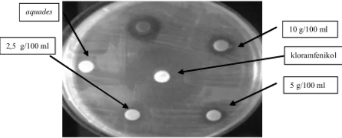 Gambar 1.      Diameter Daerah Bening Berbagai Perlakuan Infusa Daun  Jambu Biji pada Kultur  Salmonella Typhi
