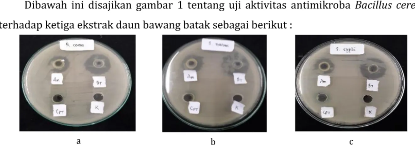 Gambar 1. Hasil uji aktivitas antimikroba  