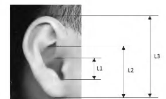 Gambar  1  Dimensi-dimensi telinga yang  diukur dalam penelitian:  L1  (panjang lubang 