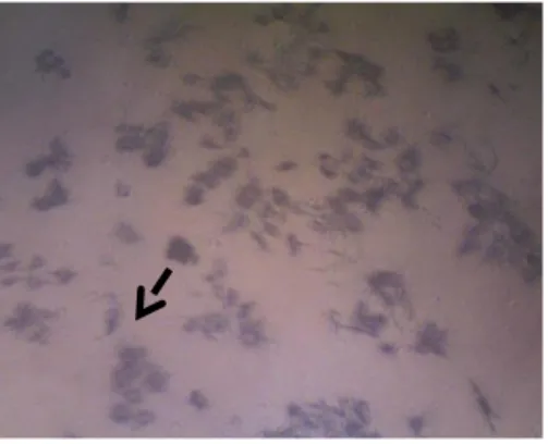 Gambar 1. Kontrol sel (sel MCF-7 + MK) (A), Sel MCF-7 dengan pemberian ekstrak etanol kulit buah naga  putih (Hylocereus undatus) konsentrasi 200 µg/mL mengalami kematian (B) Sel MCF-7 dengan ekstrak etanol 