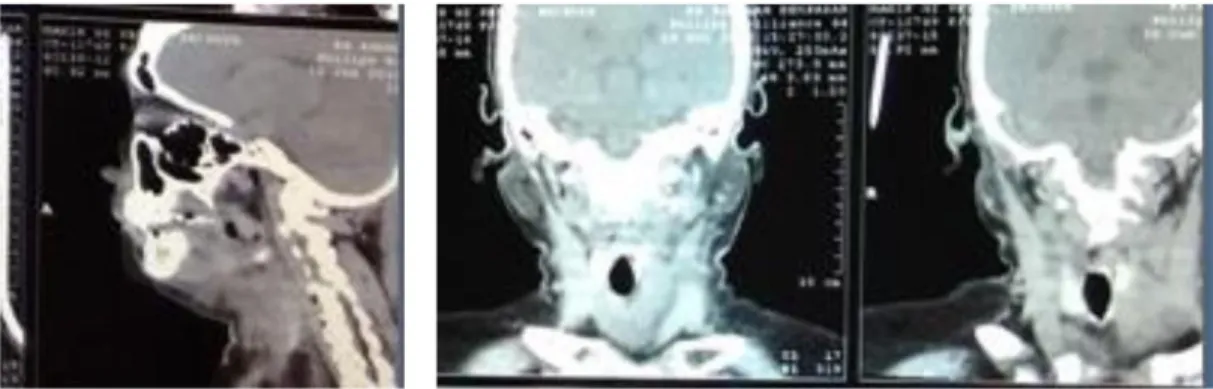 Gambar 6. CT scan kepala irisan axial dan coronal