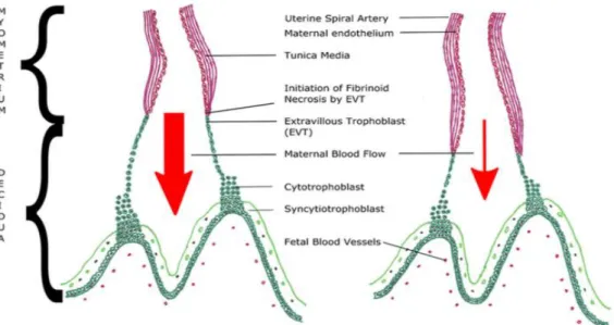 Gambar 2.  Pada gambar kiri tampak invasi sitotrofoblas ke miometrium dan aliran  darah  dari  ibu  ke  janin  cukup,  pada  gambar  kanan  tampak  invasi  sitotrofoblas ke miometrium kurang, sehingga aliran darah dari ibu ke  janin berkurang