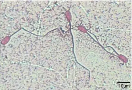 Gambar 1  Spermatozoa hasil pengeringbekuan dengan metode pewarnaan eosin B 2%.  