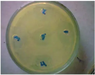 Gambar  6.  Zona  hambat  pada  Streptococcus  sp.  Kandungan  ekstrak  kayu  siwak  30  mg/ml  (Sumur  1),  25  mg/ml  (Sumur  2),  20  mg/ml  (Sumur  3),  15  mg/ml  (Sumur 4), dan 10 mg/ml (Sumur  5) 
