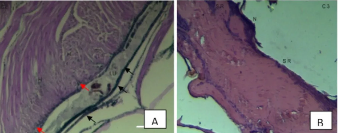 Gambar  3. Perubahan  histologi  usus  udang  uji  pada  perlakuan  A  dan  perubahan histologi  lapisan  kutikula dan  otot  udang  uji pada  perlakuan  B
