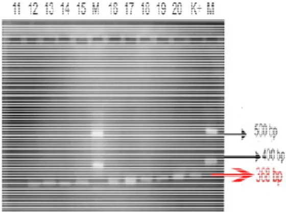 Gambar  1.  V.  parahaemolyticus    sampel  C  .moltkiana.  Prime  pada  CHROMAgar TM  Vibrio