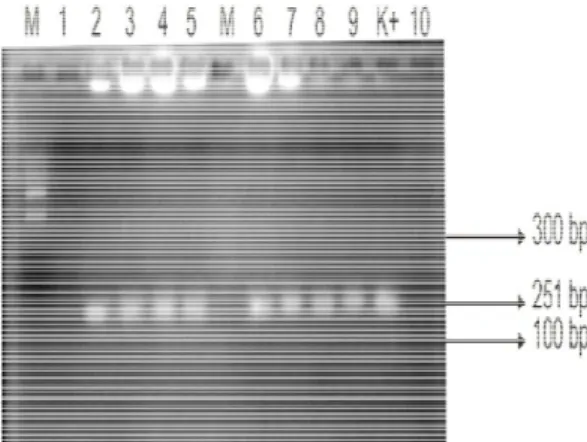 Gambar  3.  Gel  agarose  1  %    gen  tdh  hasil  elektroforesa  DNA  (C.   moltkiana