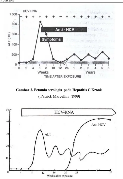 Gambar 3. Perubahan serologik infeksi HCV Kronis pasca transfusi   (Sheila Sherlock, 1995) 