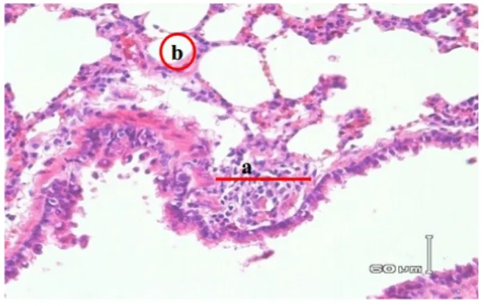 Gambar 4.  Gambaran  histopatologis  paru-paru  tikus  putih  yang  diberi  pengasapan  rokok 9 batang per hari pada kelompok  IV  (K  IV)