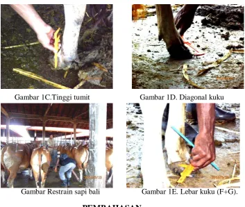 Gambar 1C.Tinggi tumit 