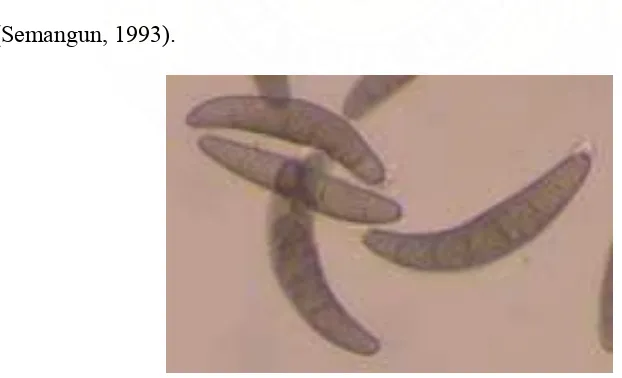 Gambar 3: Patogen Penyebab Penyakit (Helminthosporium  maydis) Sumber: Pengamatan di Mikroskop Perbesaran 40X Gejala Serangan Penyakit 