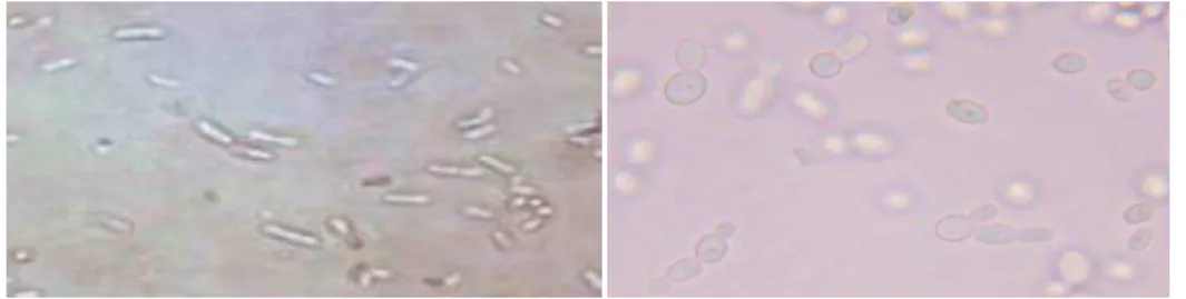 Gambar 4.9  Morfologi bakteri dengan perbesaran 400x   a.  Bakteri Z. Mobilis ATCC 10988 