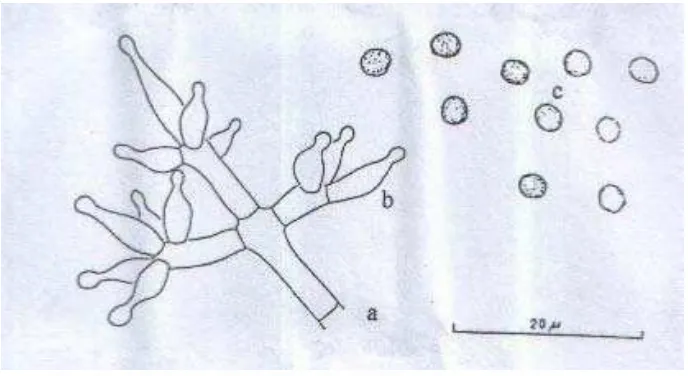 Gambar 5. Trichoderma harzianum (Perbesaran 400 X)                                     Keterangan : a