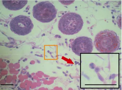 Gambar 10 Gambar sel radang neutrofil pada luka kelompok salep ekstrak pada  hari ke-7 (Pewarnaan HE, Bar 40µm) 