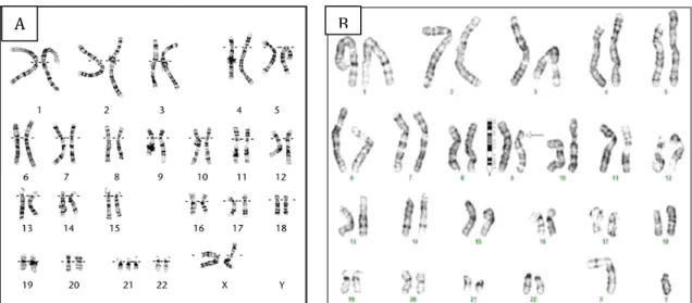 Gambar  2  Kelainan  kromosom  numerikal  trisomi  21(A) . Kelainan  kromosom  struktural 46,XY,del (9)(p22 → pter) (B) 8 