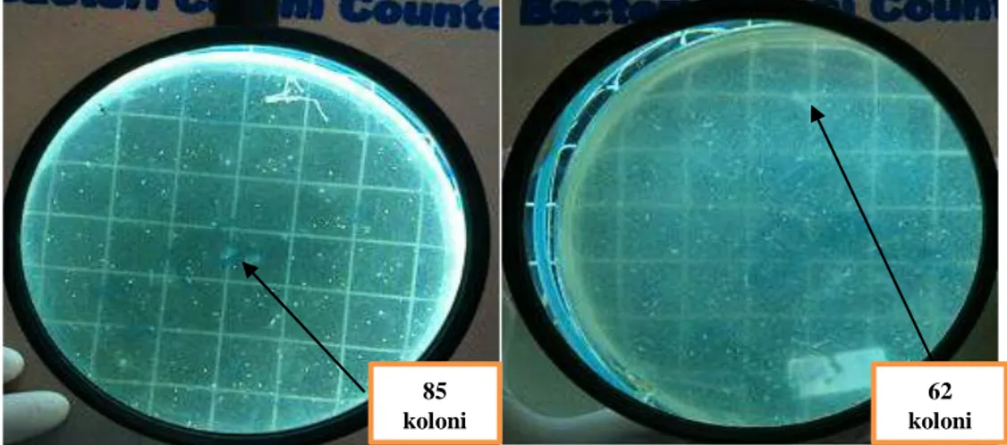 Gambar  3.  Hasil  uji  rekulturasi  air  perasan  bawang  putih  (  Allium  sativum  L)  terhadap  pertumbuhan Staphylococcus aureuspada konsentrasi 3,125% 