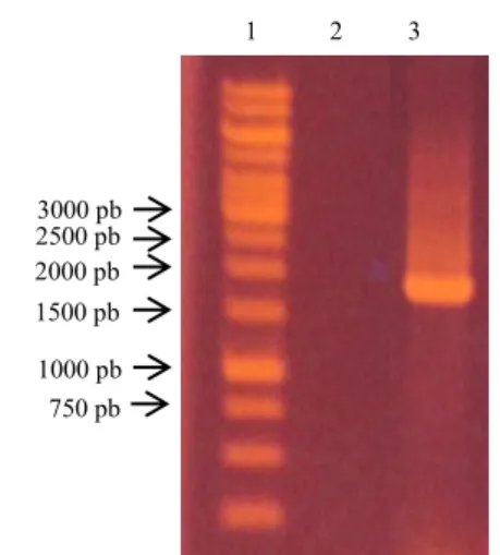 Gambar 2. Elektroferogram Hasil PCR Gen  α-Amilase. Lajur 1 Ladder 