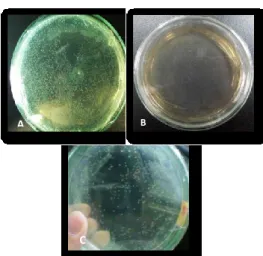 Gambar 3. A) Kontrol Positif Transformasi Sel E. coli DH5α. (B) Kontrol Negatif Transformasi  Sel E