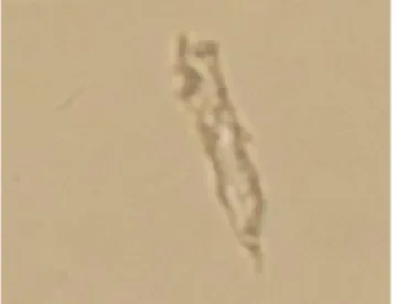 Gambar 4.4 Synedra sp.  Gambar 4.5 Rhizosolenia sp. 