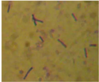 Gambar 3.1 Biakan bakteri pada perbesaran 100X  Foto mikroskopik pada Gambar  3.1 menunjukkan  adanya bakteri yang berbentuk batang (basil), dan tidak  dijumpai adanya morfologi bakteri lain sehingga dari  biakan yang ada menunjukkan bahwa spesies yang ada