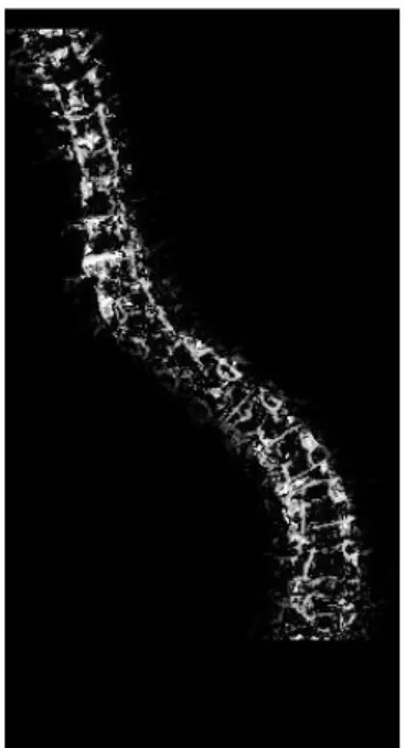 Gambar 8. Hasil CPM pada citra tulang belakang  Dari Gambar 8 dapat diketahui bahwa CPM  mampu  melakukan  segmentasi  tulang  belakang
