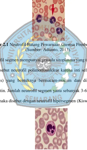 Gambar 2.1 Neutrofil Batang Pewarnaan Giemsa Pembesaran 1000 x  (Sumber: Adianto, 2013)