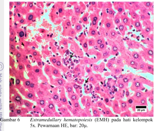 Gambar 6   Extramedullary hematopoiesis (EMH) pada hati kelompok dosis  5x. Pewarnaan HE, bar: 20µ