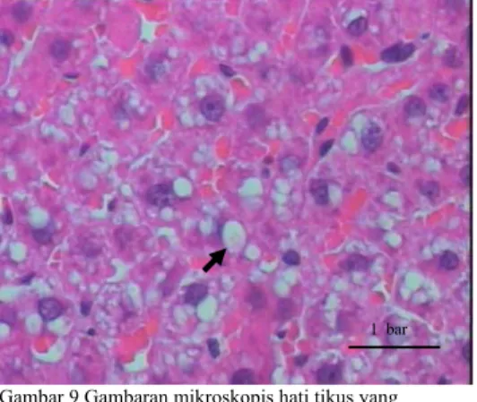 Gambar 11  Gambaran mikroskopis hati  tikus daerah                       yang normal pada kontrol pewarnaan HE, 1                        bar 50 µm