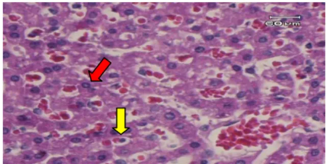Gambar 4. Gambaran mikroskopik hati tikus  wistar yang diberikan CCl 4   dilanjutkan  pemberian pellet biasa selama 5 hari