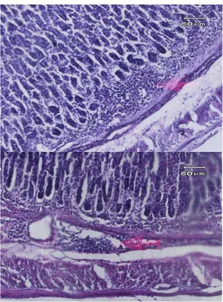 Gambar 3.  Gambaran mikroskopik lambung  tikus Wistar kelompok B (kontrol positif) yang  diberikan aspirin 30 mg selama 7 hari