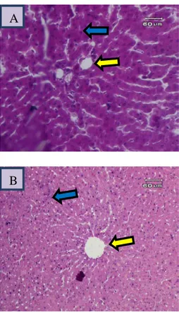 Gambar 4.  Gambaran mikroskopik hati tikus  kelompok D (perlakuan 3). Tampak gambaran  sel hati yang mengalami regenerasi pada  hampir seluruh bagian jaringan (panah biru),  hampir tidak ditemukan nekrosis pada sel dan  tampak vena sentralis (panah kuning)